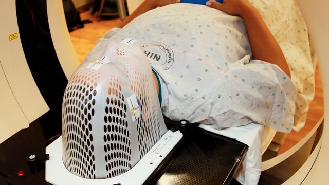 A patient laying down with a guard on their face undergoing radiotherapy. 